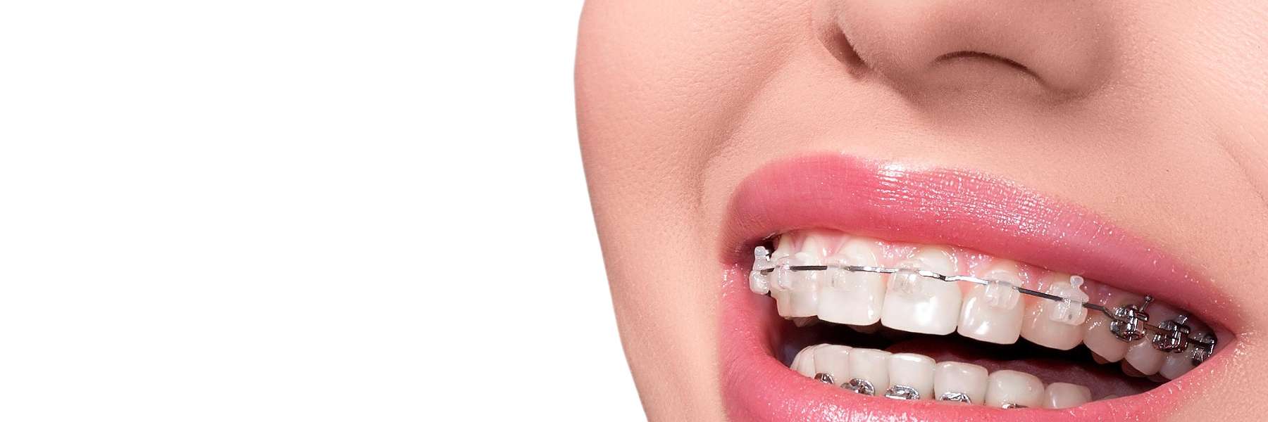 Orthodontics | Dentist